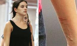 Con gái Tom Cruise gây hoang mang khi để lộ những vết thương ở cổ tay, liệu có phải là dấu hiệu của bệnh tâm lý?