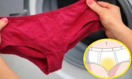 Vì sao đáy quần lót phụ nữ có màu vàng? Nó không phải là bệnh lý, biết sớm để bớt lo lắng