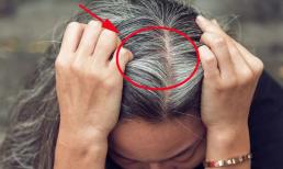 Người có tóc bạc thường tìm cách nhuộm hoặc nhổ bỏ, nhưng ít ai biết để nguyên cũng có ích