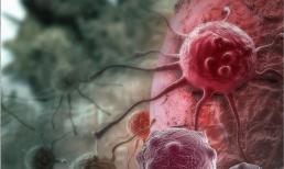 WHO ban đầu công bố danh sách chất gây ung thư cấp độ 1: Không muốn kích động ung thư, đừng dễ dàng ăn 4 loại thực phẩm 