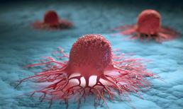 Tế bào ung thư sợ nhất một điều, đặc biệt khi bạn làm trong khoảng thời gian này