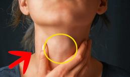 Nếu có ung thư trong cơ thể, cổ có phải là tiên tri? 3 loại bất thường trên cổ có thể là cảnh báo bệnh tật hoặc ung thư