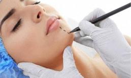 Vì sao ngày càng có nhiều phụ nữ phẫu thuật thẩm mỹ bộ phận sinh dục?