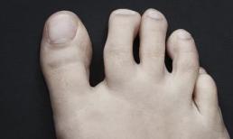 Nếu 3 tình trạng này xuất hiện ở bàn chân có thể là điềm báo trước của bệnh “ung thư”, vì vậy đừng bỏ qua