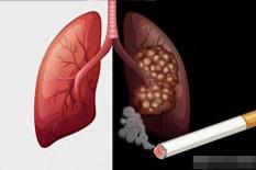 Tại sao có người hút thuốc cả đời mà không bao giờ bị ung thư phổi, trong khi có người không hút thuốc lại bị ung thư? Cho bạn biết lý do tại sao