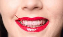 Son môi dính răng gây mất thẩm mỹ, phải làm sao? Bạn hãy thử làm điều này
