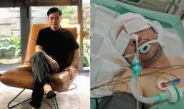 Ca sĩ Tuấn Dương bị chấn thương sọ não do tai nạn giao thông, bạn bè kêu gọi giúp đỡ