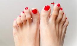 Sở hữu điểm này trên bàn chân, sinh ra bạn đã có số giàu sang, càng nhiều tuổi càng phát tài