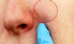 Tại sao lỗ chân lông vẫn to như vậy? Nếu không thay đổi 9 điểm này thì mỹ phẩm dù có tốt đến đâu cũng vô dụng