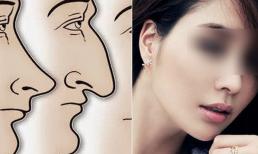 Xem qua tướng mũi đoán hôn nhân cực chuẩn xác, bạn thuộc số mấy? 