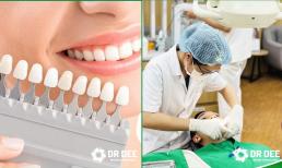 8 màu răng sứ đẹp được lựa chọn nhiều nhất