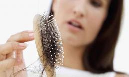 Mẹo hay nên làm trước và sau khi gội đầu giúp giảm hẳn gãy rụng tóc trong mùa Đông