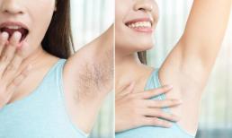 Nhiều người có lông nách rậm nhưng lại có những người không có lông nách dù đã qua tuổi dậy thì, phụ nữ không có lông nách có sao không?