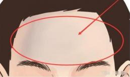 Bạn thuộc loại trán nào? Đoán vận mệnh và cuộc sống qua trán của bạn!