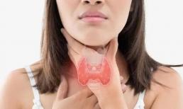 U tuyến giáp “thích” phụ nữ hơn, nếu ăn 4 loại thực phẩm này, u tuyến giáp có thể từ từ “tiêu tán”