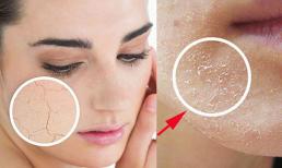 Da nứt nẻ, khô ráp vào mùa đông, bôi thứ này vào đảm bảo căng bóng, không tốn tiền