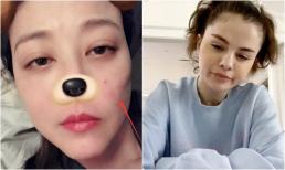 Căn bệnh quái ác khiến Châu Hải My rời xa trần thế đáng sợ như thế nào? Đến Selena Gomez cũng từng khuất phục trước nó