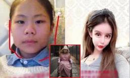 Cô gái tiêu tốn hơn 13 tỷ sau hàng trăm ca phẫu thuật thẩm mỹ, cuối cùng phải ngồi xe lăn và gần như bị cắt bỏ bộ ngực 