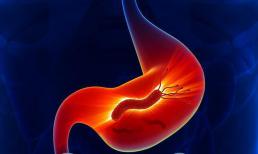 Các triệu chứng khi bị nhiễm Helicobacter pylori (HP) là gì? Cảnh báo ba thực phẩm là 'ổ sản sinh' vi khuẩn HP