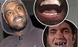 Kanye West 'chơi lớn', nhổ hết răng thật và thay thế bằng răng giả titan có giá hơn 20 tỷ nhưng liền bị phanh phui nợ tiền 