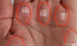 Tục ngữ có câu: “Ba đỉnh trong lòng bàn tay mang lại phú quý”. Tam đỉnh này ám chỉ điều gì? Bạn có ba đỉnh không?