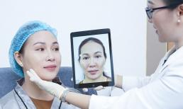 Những lợi ích không tưởng của 'Làm đầy tự thân Maxfill Nano' dưới góc nhìn bác sĩ Phương Trúc