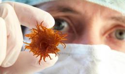 Ung thư di căn nhanh như thế nào? Nhắc nhở: Khi ung thư lan rộng, 4 loại bất thường có thể xảy ra trong cơ thể