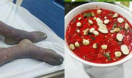 Liên cầu khuẩn lợn là bệnh gì? Cảnh báo món ăn có thể 'gây tử vong' ngày cận Tết