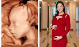 Thu Quỳnh lần đầu khoe dung mạo ái nữ trong bụng, độ giống mẹ gây bất ngờ 