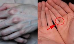 Nhìn bàn tay nhận biết ngày người lắm nghiệp ít phúc, bạn có không? 