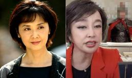 Lưu Hiểu Khánh và Chu Lâm đều đã ở tuổi 70, người dù không phẫu thuật thẩm mỹ và có nếp nhăn nhưng vẫn xinh đẹp, người còn lại ngày càng giống tượng sáp