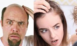 Đàn ông thường hói đầu còn phụ nữ thì hiếm khi, lý do hóa ra liên quan đến điểm này 