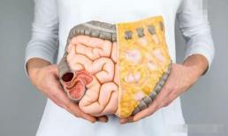 Nói chung, những người thích ăn ba loại thực phẩm này sẽ không bị bệnh đường ruột.