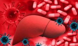 Vitamin cũng có thể gây hại cho gan? Bác sĩ nhắc nhở: Không nên uống 4 loại vitamin này lâu dài