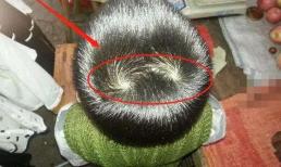 Trẻ có hơn “2 vòng xoáy” trên đầu có nghĩa là gì? Có liên quan đến chỉ số IQ không? 