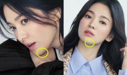 Phụ nữ có ba nốt ruồi này trên mặt được coi là 'tướng mệnh vàng', sẽ giàu có và sở hữu khối tài sản 'kếch xù'