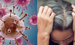 Tôi nhuộm tóc hai lần một năm và 10 năm sau được chẩn đoán mắc bệnh ung thư! Bác sĩ nhắc nhở: Người thuộc nhóm 5 thực sự không thích hợp để nhuộm tóc