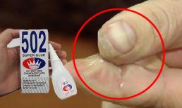 Keo 502 dính lên tay, ngâm ngay vào thứ nước này để gỡ ra nhanh chóng, không đau rát, làm ngay nhé!