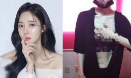 Cựu thành viên T-ara tung ảnh bị chồng cũ đánh đập dã man trước mặt các con, phải trốn về nhà bố mẹ đẻ