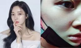 Cựu thành viên T-ara tự tử sau khi tung ảnh tố chồng cũ đánh đập dã man trước mặt các con