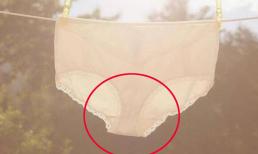 Vì sao đồ lót nữ chuyển sang màu vàng, có phải bị viêm? 