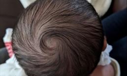 Có câu: Trẻ em càng có “xoáy tóc” rõ trên đầu sẽ càng thông minh hơn, điều này đúng hay sai? khoa học hơn đang đến