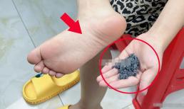 Buổi tối trước khi đi ngủ, tôi đốt ngải cứu thành tro rồi bôi vào lòng bàn chân. Không ngờ tác dụng lại mạnh mẽ đến vậy, đáng tiếc là ít người biết đến! 