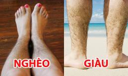 Người xưa dạy: 'Đàn ông lông chân thì giàu, phụ nữ lông chân thì nghèo', vì sao lại như vậy? 