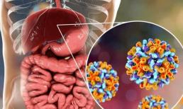 Đường ruột có 8 dấu hiệu này chứng tỏ nó đang cực kỳ bẩn, cảnh báo cơ thể sẽ ngày càng nhiều bệnh, cần thay đổi