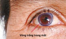 Bạn sống được bao lâu? Có thể biết chỉ bằng cách nhìn vào mắt mình? Bác sĩ nhắc: Mắt có 2 đặc điểm sống lâu hơn