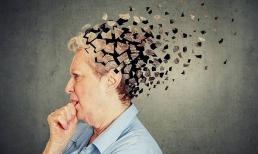 Đã tìm ra nguyên nhân gây bệnh Alzheimer! Hãy chú ý đến những thói quen ăn uống này!