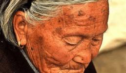 Tại sao một số người có nhiều đốm đồi mồi trong khi những người khác hầu như không có? Câu trả lời là đây 