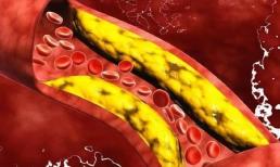 Cụ bà 107 tuổi có mạch máu chỉ ở tuổi 50. Bí quyết trường thọ không phải đi bộ nhiều mà là 3 điều này 