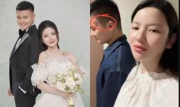 Quang Hải bị soi vết tích lạ ngay trên mặt, Chu Thanh Huyền vội lên tiếng khi bị nghi 'tác động vật lý' với chồng 